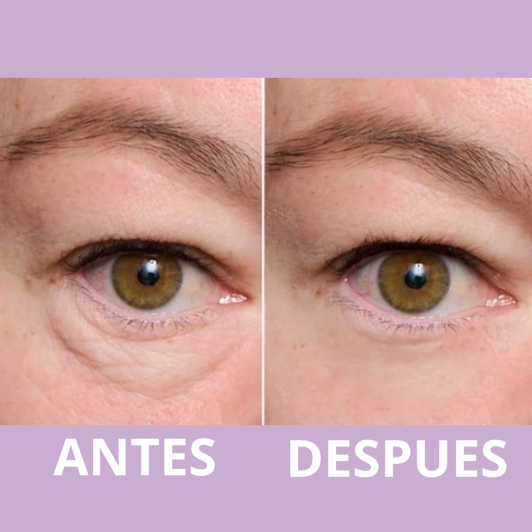 Tensor de ojos instantáneo, fórmula fácil de usar con cepillo grátis! 🎁HOY 40%DCTO